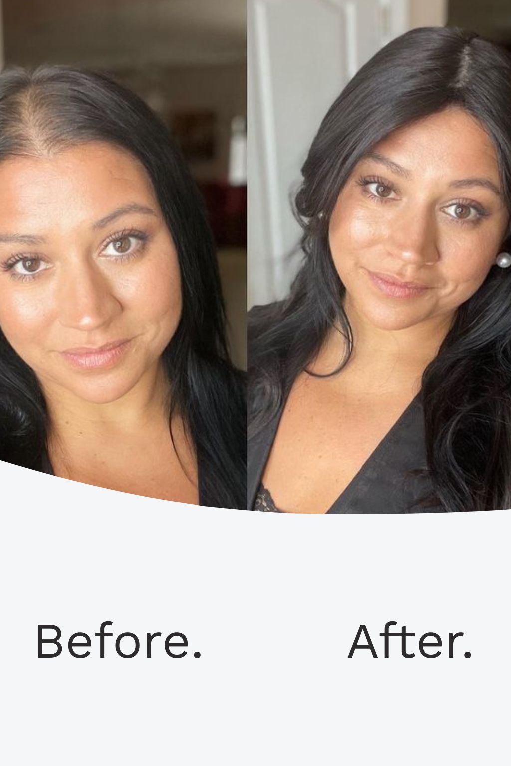 Harmony HairDensity+