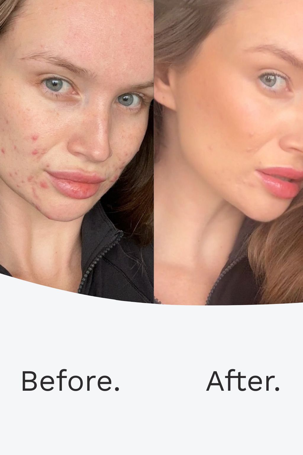 Harmony Flawless Skin