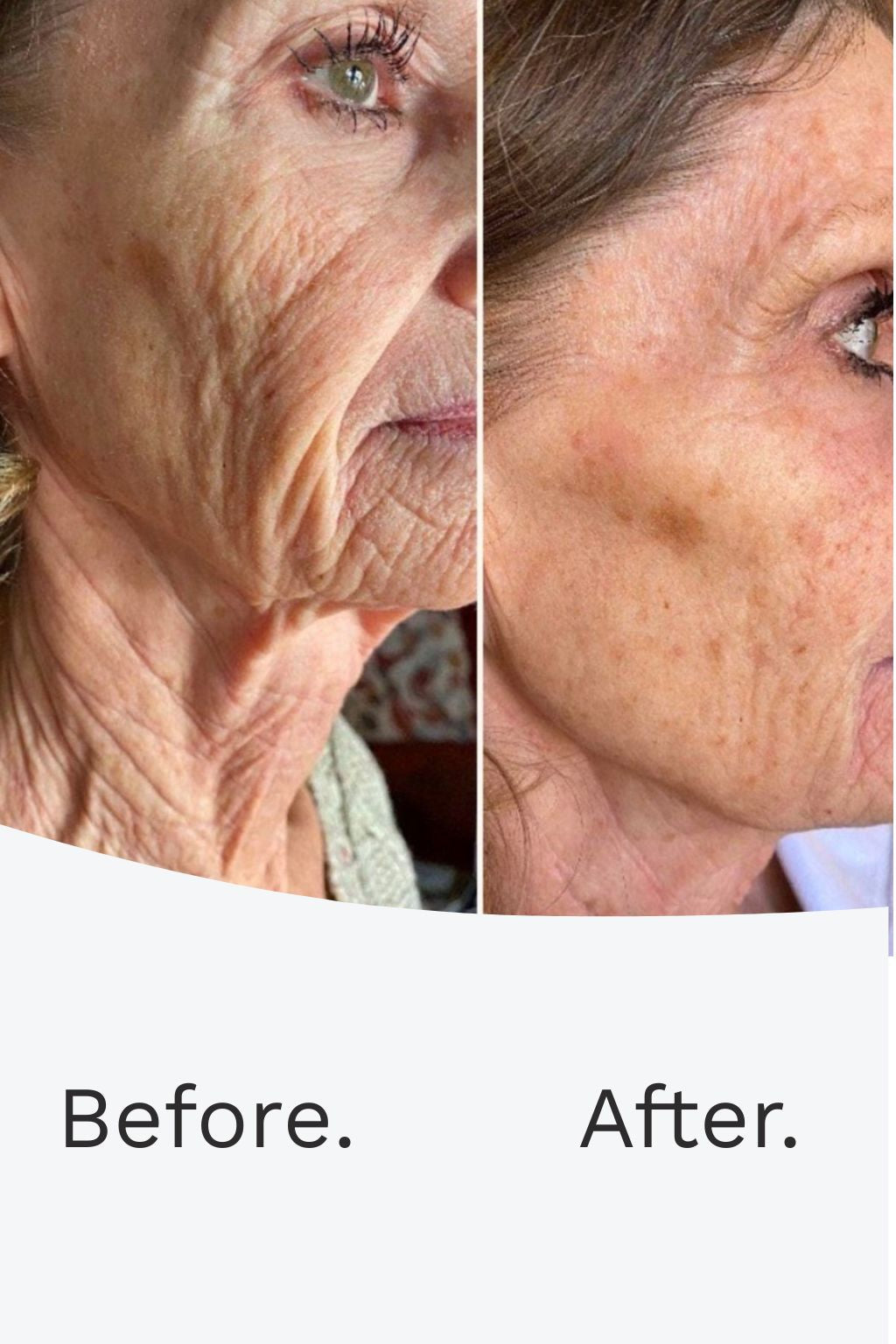 SKIN RENEWAL TIGHTENING FORMULA