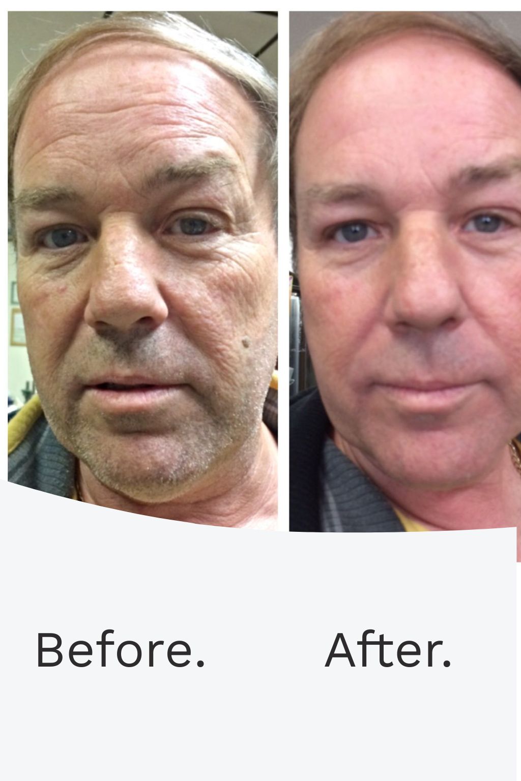 SKIN RENEWAL TIGHTENING FORMULA