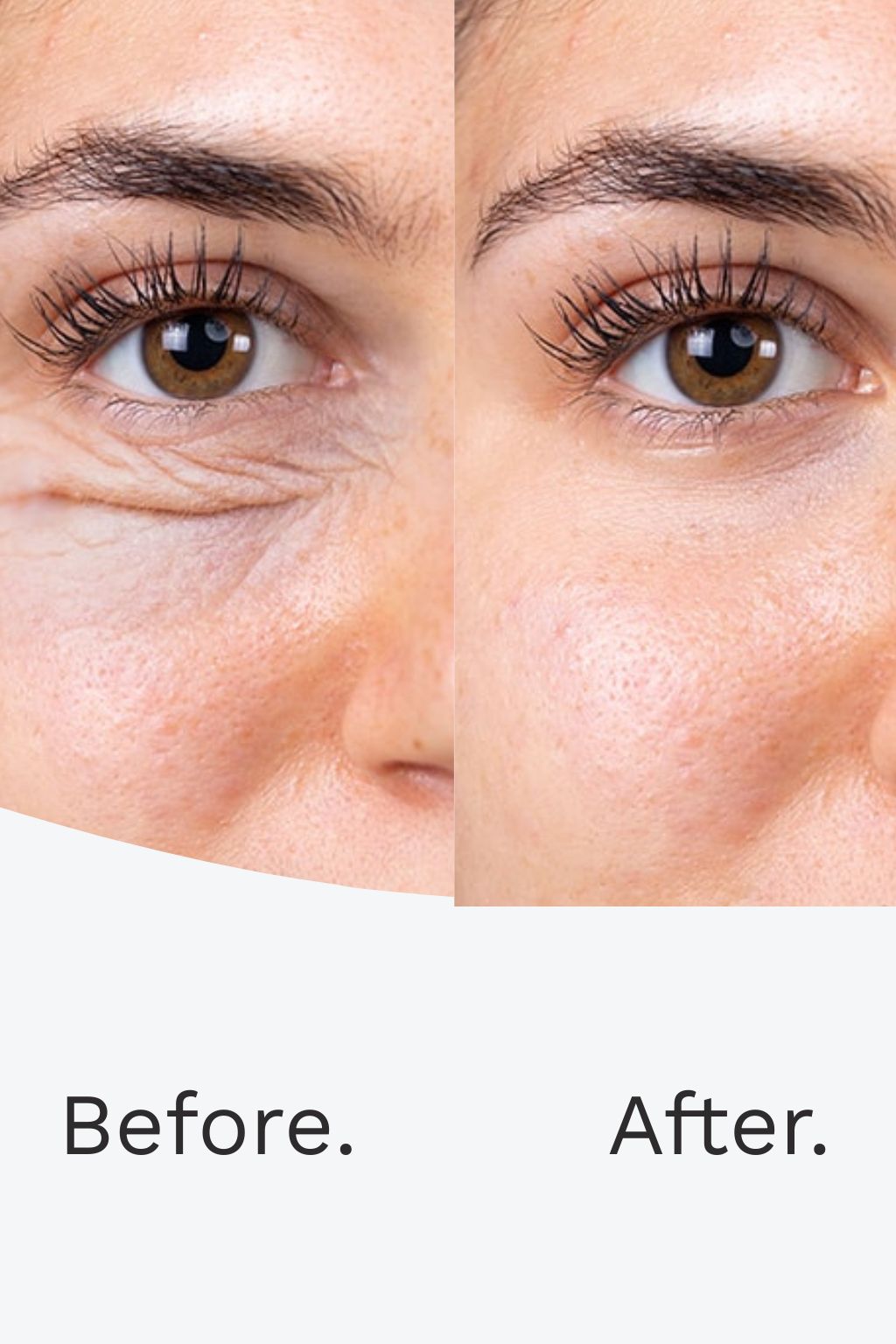 ULTRA VISION REGEN ™