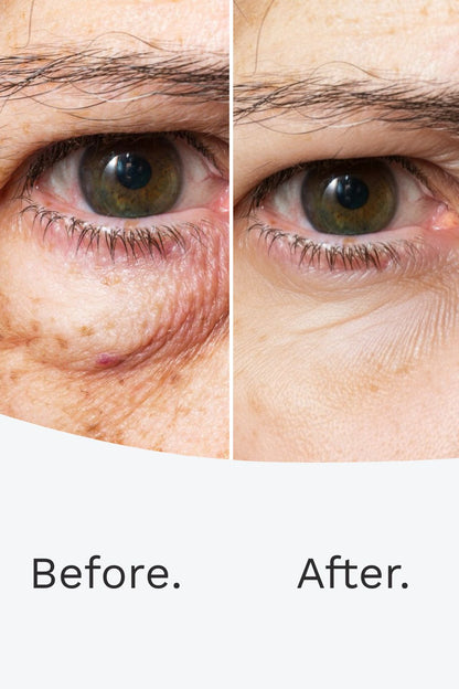 ULTRA VISION REGEN ™