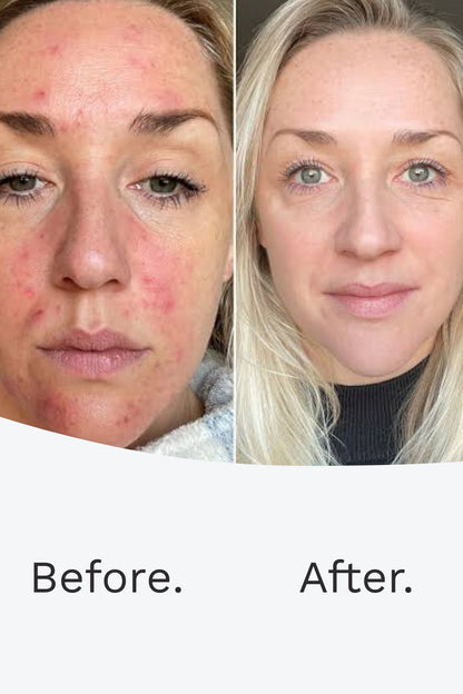 Harmony Flawless Skin